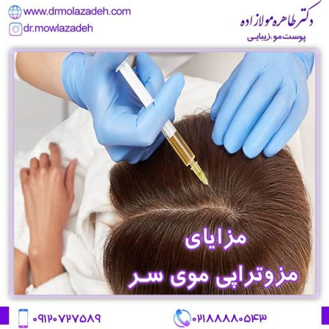درمان ریزش مو با مزوتراپی