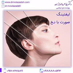 لیفت صورت با نخ