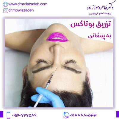 مراقبت های بعد از تزریق بوتاکس