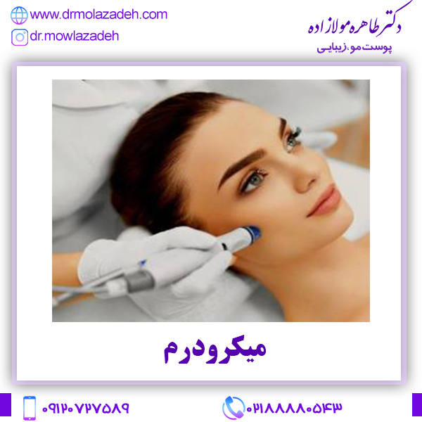 میکرودرم