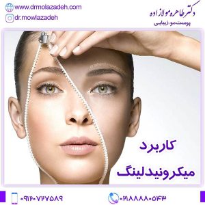 میکرونیدلینگ