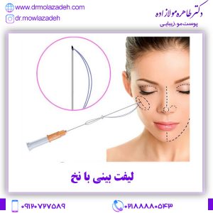 لیفت بینی با نخ