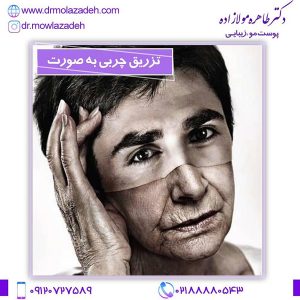 مراقبت های بعد از تزریق چربی