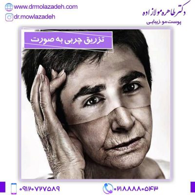 مراقبت های بعد از تزریق چربی