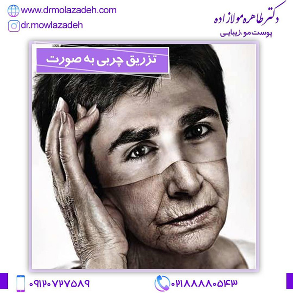 مراقبت های بعد از تزریق چربی