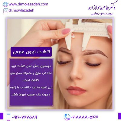 مراقبت های بعد از کاشت ابرو