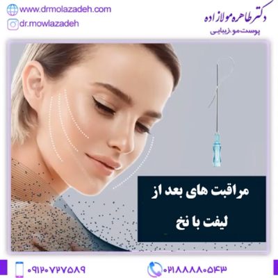 مراقبت های بعد از لیفت با نخ