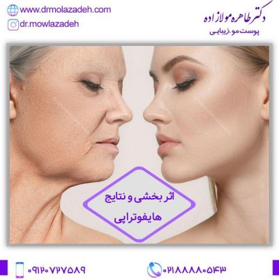 هایفوتراپی