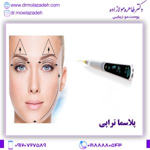 پلاسما تراپی