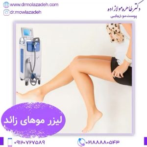 لیزر موهای زائد