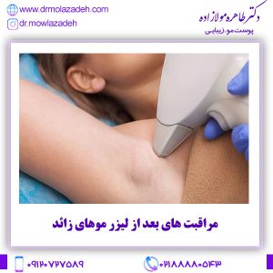 مراقبت های بعد از لیزر موهای زائد