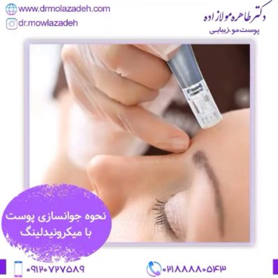 مراقبت های بعد از میکرونیدلینگ