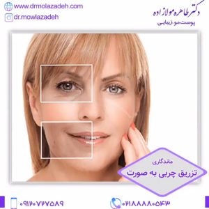 تزریق چربی در تهران