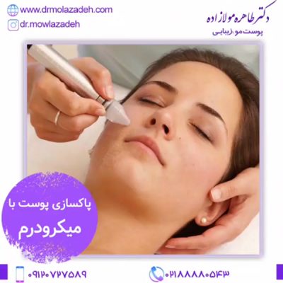 مراقبت های بعد از میکرودرم
