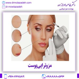 مزوتراپی پوست