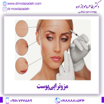 مزوتراپی پوست