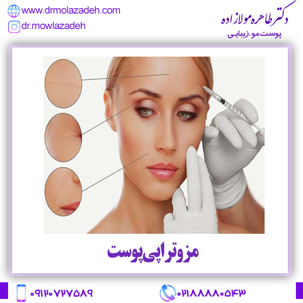 مزوتراپی پوست