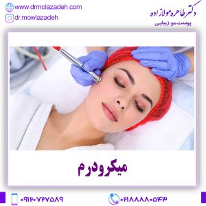 میکرودرم
