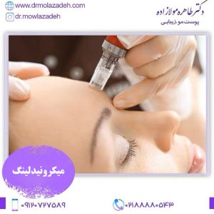 میکرونیدلینگ