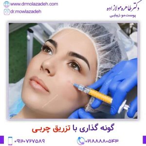 مراقبت های بعد از تزریق چربی