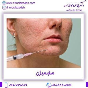 سابسیژن در تهران