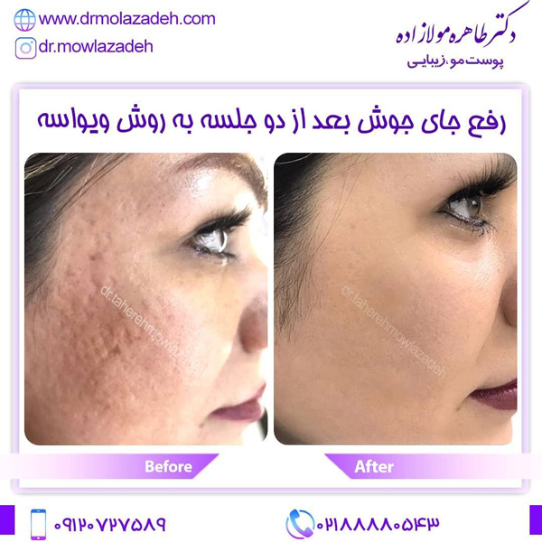 ویواسه